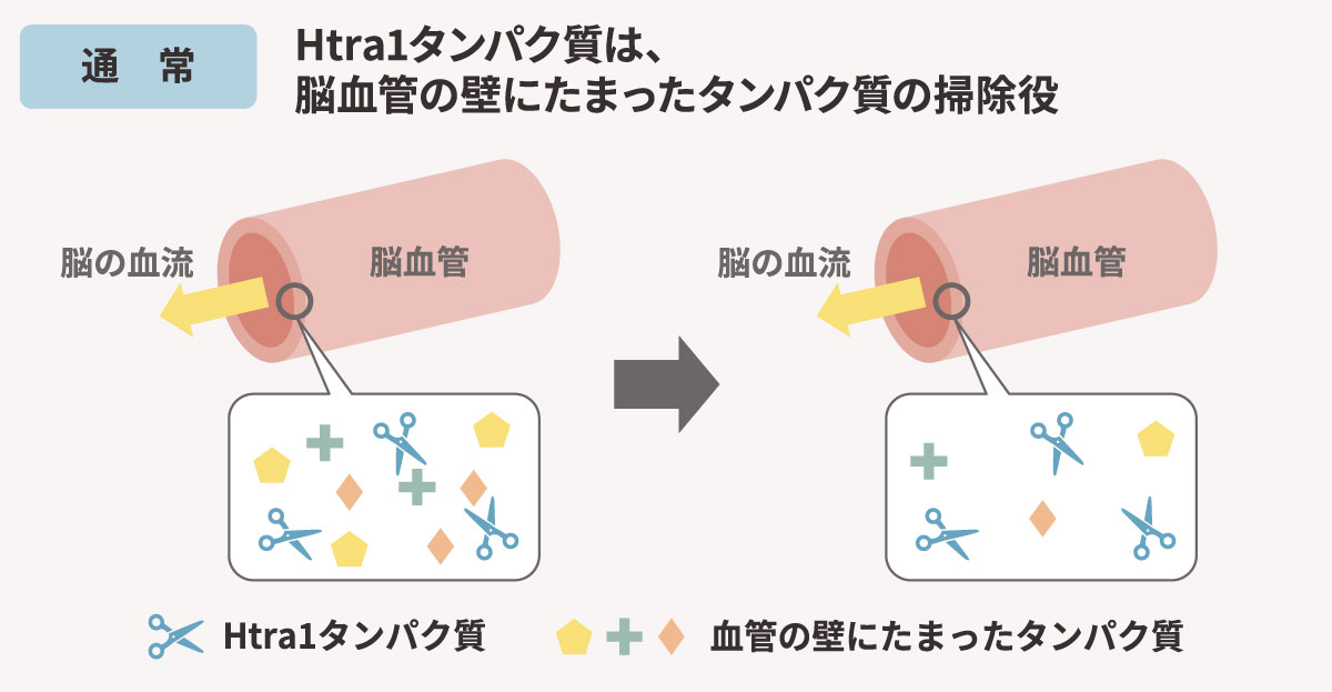 HTRA1は、脳血管の壁にたまったタンパク質の掃除役