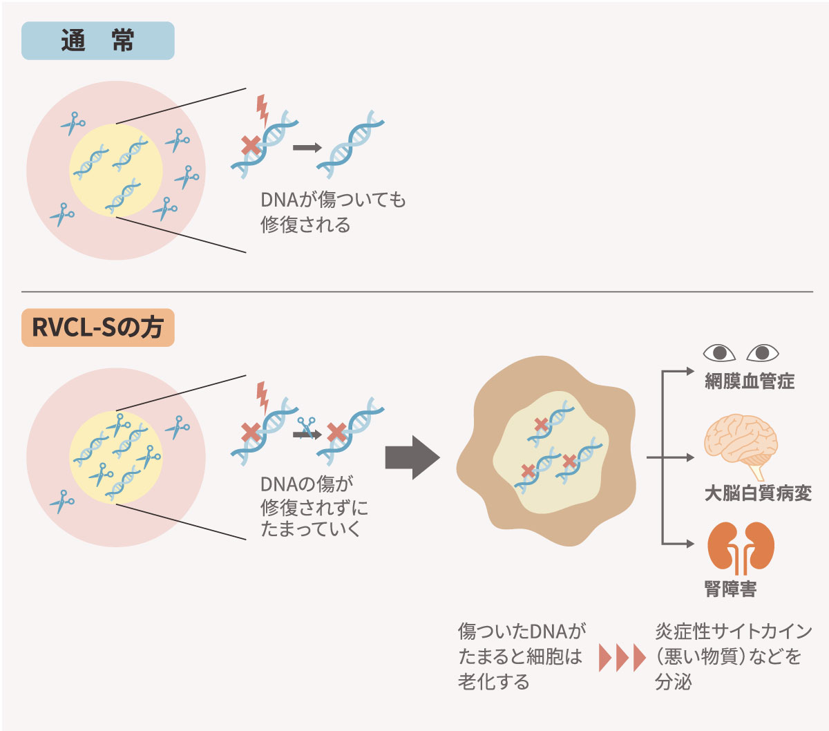 RVCL-S患者さんの脳MRI画像
